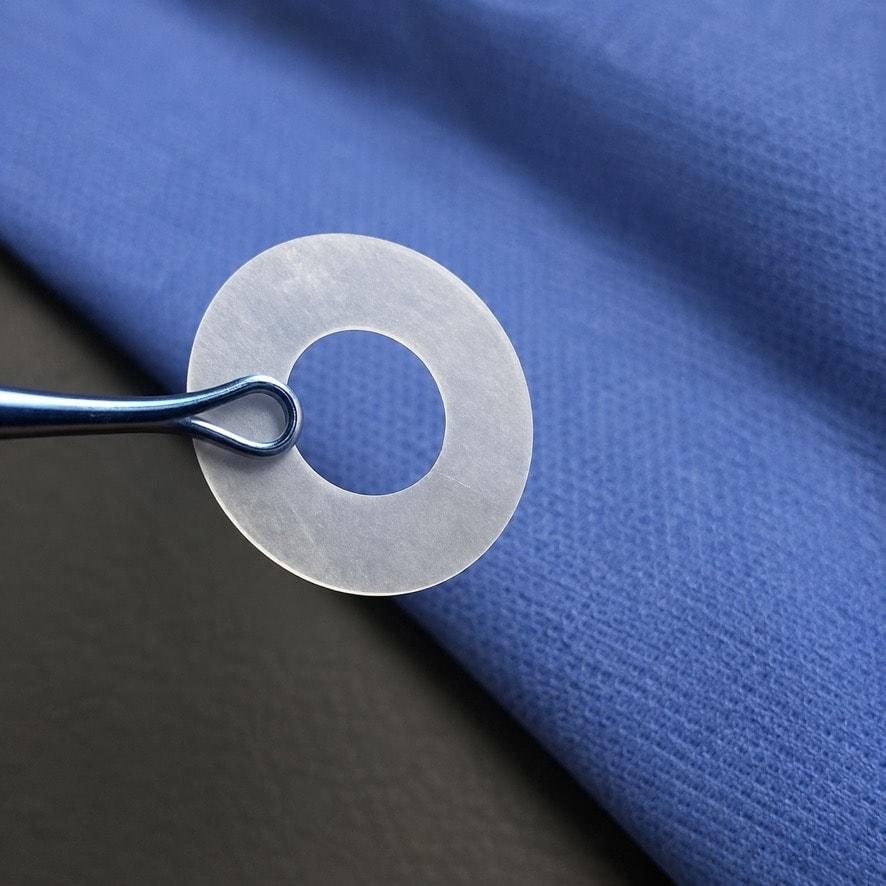 Aurora amniotic membrane disc showing the patented 5 mm central aperture