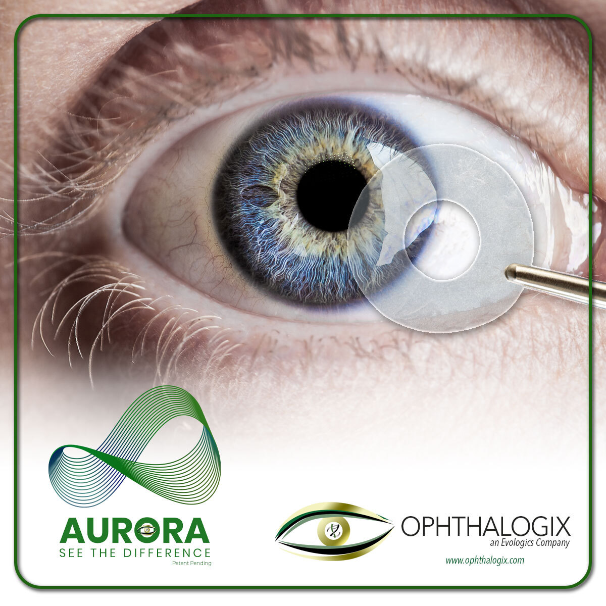 Ophthalogix Aurora AMT better for your practice and patients