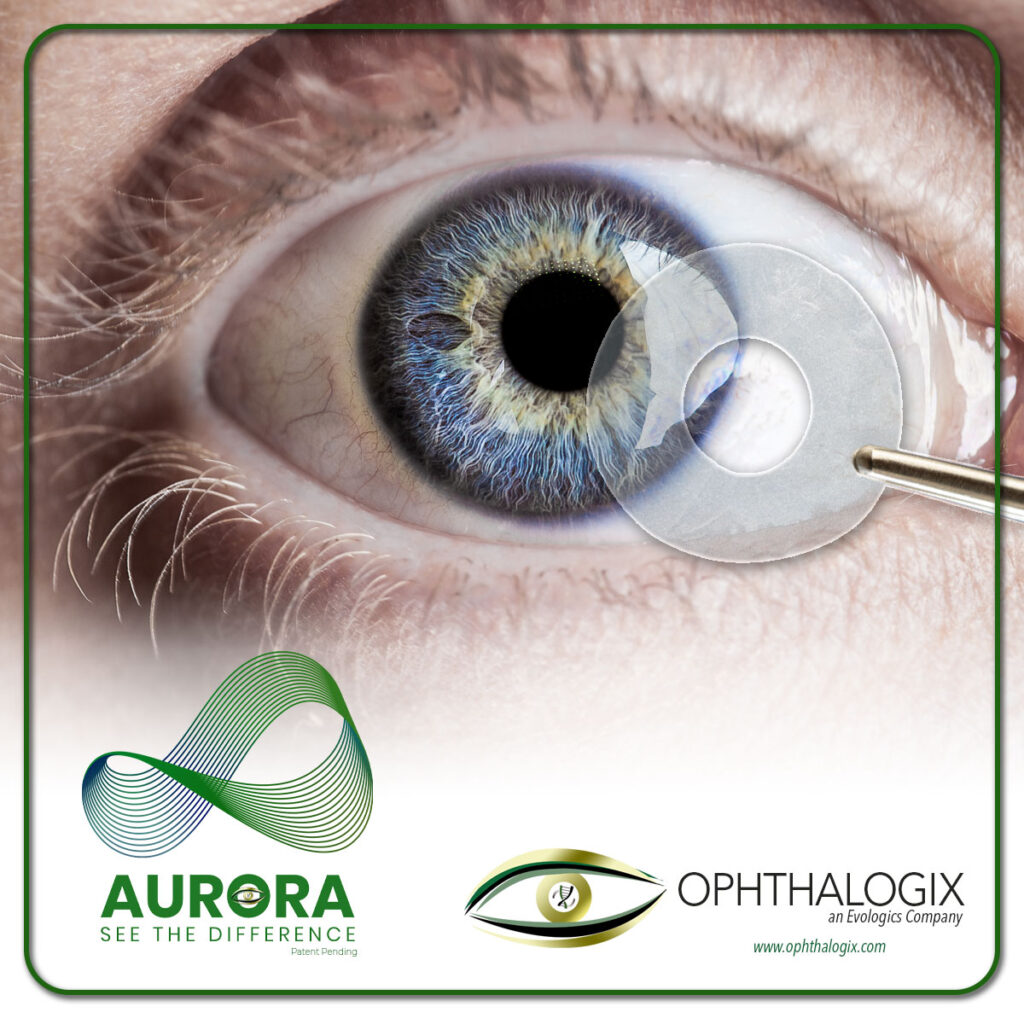 A picture of Ophthalogix Aurora amniotic membrane for treating patients with various eye conditions