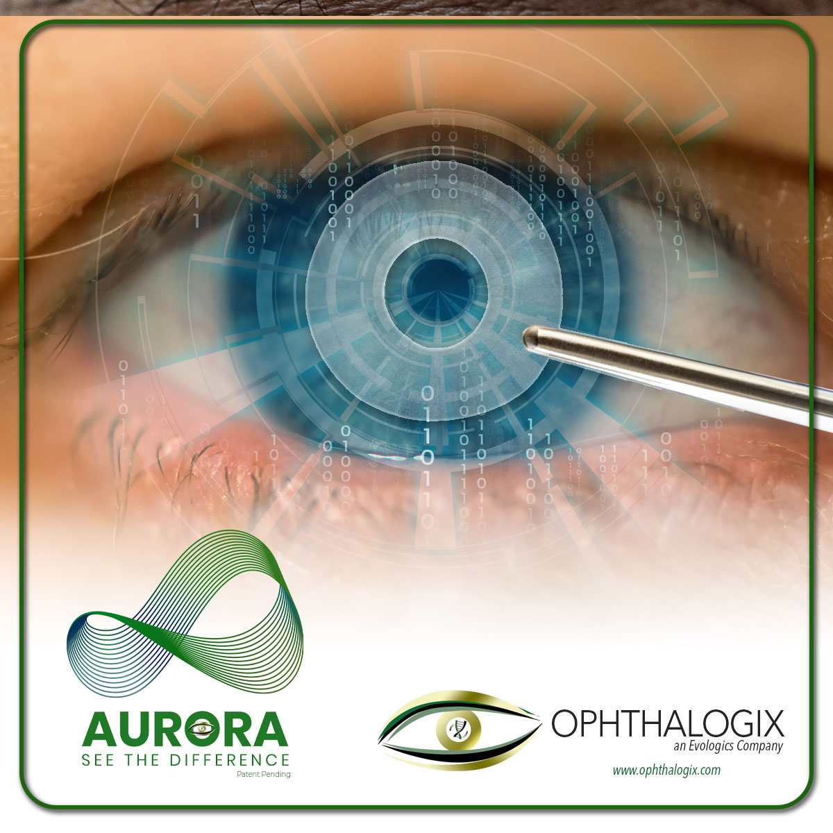Ophthalogix Aurora AMT for eyes
